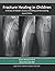Fracture Healing in Children: A Review of Pediatric Osseous Modeling and Remodeling Second Edition