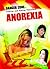 Anorexia