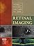 Retinal Imaging