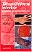 Skin and Wound Infection: I...