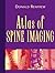 Atlas of Spine Imaging by Donald Renfrew MD