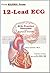 12-lead ECGs: Practice Exer...