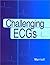 Challenging ECGs