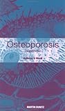 Osteoporosis: Pocketbook