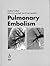 Pulmonary Embolism: Epidemiology, Diagnosis and Treatment