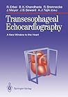 Transesophageal Echocardiography: A New Window to the Heart Transesophageal Echocardiography: A New Window to the Heart