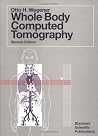 Whole Body Computed Tomography Whole Body Computed Tomography