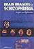 Brain Imaging in Schizophreniained: Insights and Applications