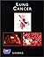 Lung Cancer
