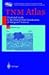 Tnm Atlas : Illustrated Guide to the Tnm/Ptnm-Classification of Malignant Tumors (Nicc International Union Against Cancer)