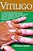Vitiligo: Current Knowledge & Nutritional Therapy