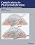 Complications in Phacoemulsification. Avoidance, Recognition, and Management.
