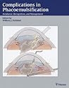 Complications in Phacoemulsification. Avoidance, Recognition, and Management. Complications in Phacoemulsification. Avoidance, Recognition, and Management.