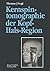 Kernspintomographie der Kopf-Hals-Region: Funktionelle Topographie ― klinische Befunde ― Bildgebung ― Spektroskopie (German Edition)