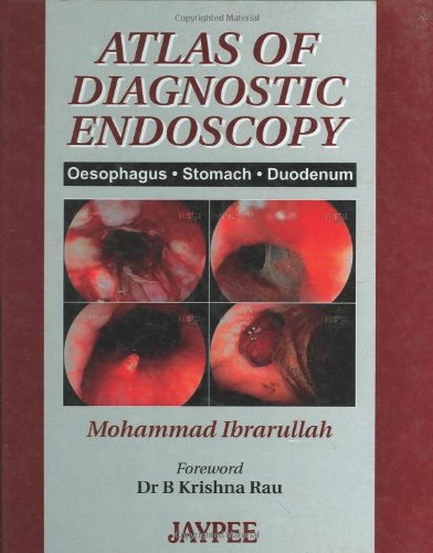 Atlas of Diagnostic Endoscopy (Paperback)