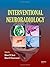 Interventional Neuroradiology