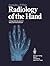 Radiology of the Hand: A Diagnostic Synopsis of Many General Diseases