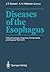 Diseases of the Esophagus