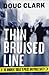 Thin Bruised Line: The Immi...