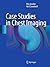 Case Studies in Chest Imaging