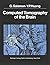 Computed Tomography of the Brain: Atlas of Normal Anatomy