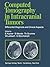Computed Tomography in Intracranial Tumors: Differential Diagnosis and Clinical Aspects