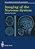 Imaging of the Nervous System