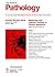 The Journal of Pathology, Molecular & Cellular Themes in Canc... by P.A. Hall
