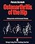 Osteoarthritis of the Hip: ...