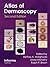 Atlas of Dermoscopy