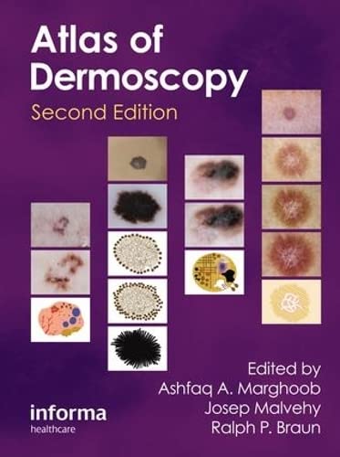Atlas of Dermoscopy (Hardcover)