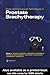 Basic and Advanced Techniques in Prostate Brachytherapy by Adam P. Dicker