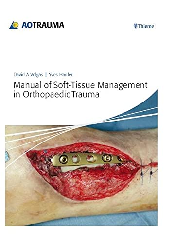 Manual of Soft-Tissue Management in Orthopaedic Trauma (Kindle Edition)