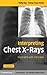 Interpreting Chest X-Rays: Illustrated with 100 Cases