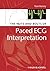 The Nuts and bolts of Paced ECG Interpretation