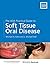 The ADA Practical Guide to Soft Tissue Oral Disease