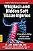 Whiplash and Hidden Soft Tissue Injuries by Dr R Jay Shetlin