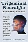 Trigeminal neuralgia: a complete guide book. Trigeminal neuralgia: causes, symptoms, treatments, surgery,