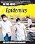 Epidemics