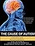 The Cause of Autism - Concepts and Misconceptions