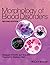 Morphology of Blood Disorders