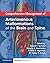 Comprehensive Management of Arteriovenous Malformations of th... by Robert Spetzler