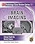 Radiology Case Review Series: Brain Imaging