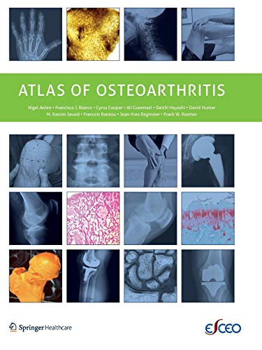 Atlas of Osteoarthritis (Paperback)