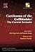 Carcinoma of the Gallbladder: The Current Scenario - Ecab - E-Book