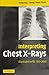 Interpreting Chest X-Rays South Asia Edition by Philip Eng