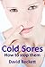 Cold Sores: How to stop them