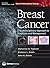 Breast Cancer: CMO E-Book