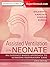 Assisted Ventilation of the Neonate: Evidence-Based Approach to Newborn Respiratory Care