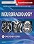 Neuroradiology Imaging Case Review